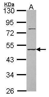 Anti-DAZ3 antibody used in Western blot. GTX106859