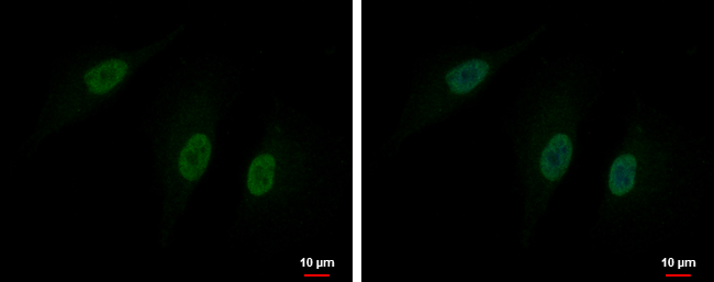 Anti-DBF4B antibody used in ICC/IF. GTX120796