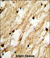 Anti-DCC1 antibody, N-term used in IHC (Formalin-fixed paraffin-embedded sections). GTX81965