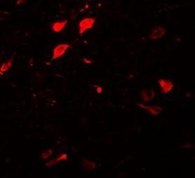 Anti-DCLK3 antibody used in ICC/IF. GTX85203