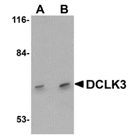 Anti-DCLK3 antibody used in Western blot. GTX85203