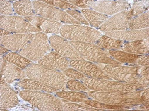 Anti-DCUN1D4 antibody used in IHC (Formalin-fixed paraffin-embedded sections). GTX107380