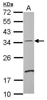 Anti-DCUN1D4 antibody used in Western blot. GTX107380