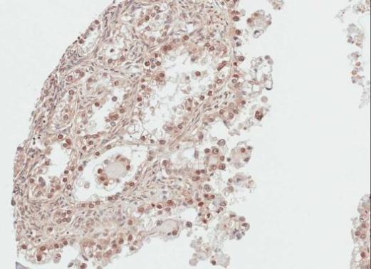 Anti-DDI1 antibody [N1C3] used in IHC (Formalin-fixed paraffin-embedded sections). GTX103772