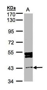 Anti-DDI1 antibody [N1C3] used in Western blot. GTX103772