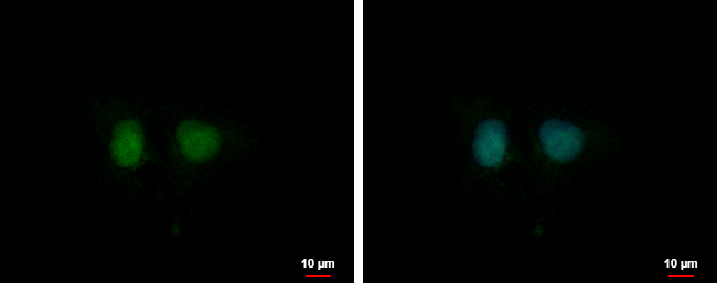 Anti-DDI1 antibody [N1C3] used in ICC/IF. GTX103772