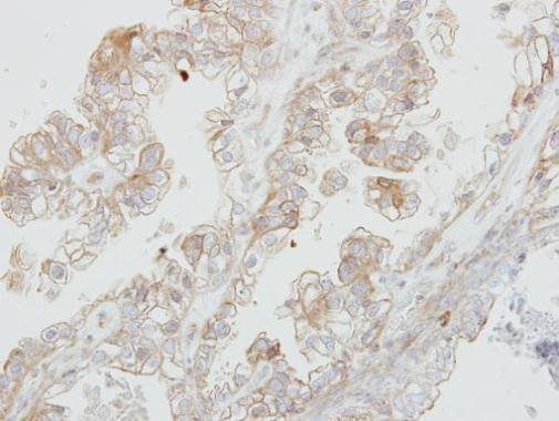 Anti-DDR1 antibody [N1N3] used in IHC (Formalin-fixed paraffin-embedded sections). GTX111453