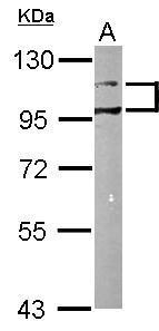 Anti-DDR1 antibody [N1N3] used in Western blot. GTX111453