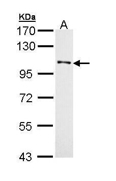 Anti-DDR1 antibody [N1N3] used in Western blot. GTX111453