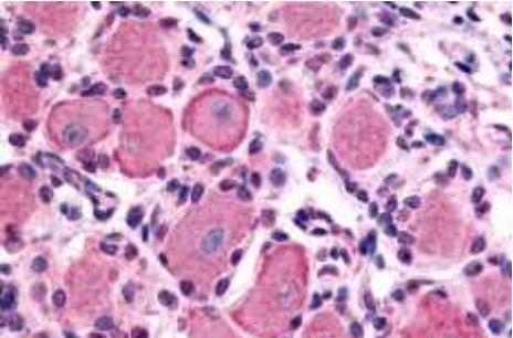 Anti-5-HT1D receptor antibody used in IHC (Formalin-fixed paraffin-embedded sections). GTX78101