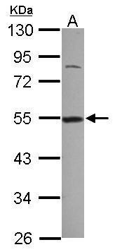 Anti-DDX39 antibody [C1C3] used in Western blot. GTX118582