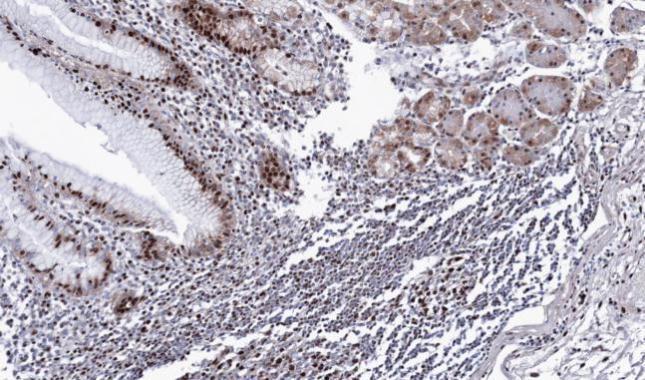 Anti-DDX39 antibody [N1C3] used in IHC (Formalin-fixed paraffin-embedded sections). GTX106001