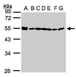 Anti-DDX39 antibody [N1C3] used in Western blot. GTX106001