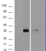 Anti-AKR1B10 antibody, C-term used in Western blot. GTX88827
