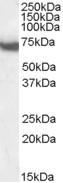 Anti-DDX5 / p68 RNA helicase antibody, C-term used in Western blot. GTX10261