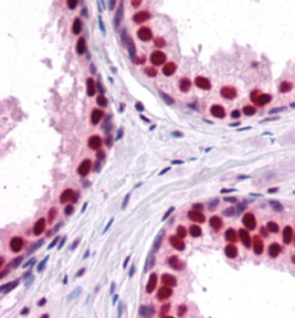 Anti-DDX5 / p68 RNA helicase antibody, C-term used in IHC (Formalin-fixed paraffin-embedded sections). GTX10261