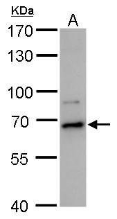 Anti-DDX52 antibody used in Western blot. GTX120797