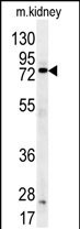 Anti-DDX53 antibody, C-term used in Western blot. GTX81413