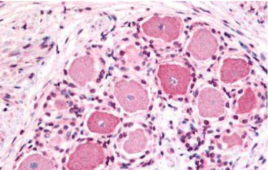 Anti-5-HT1D receptor antibody used in IHC (Formalin-fixed paraffin-embedded sections). GTX78103