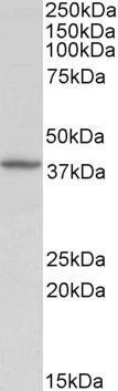 Anti-Decorin antibody, Internal used in Western blot. GTX88387