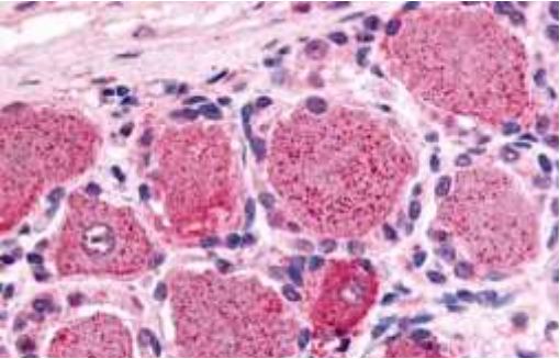 Anti-5-HT1D receptor antibody used in IHC (Formalin-fixed paraffin-embedded sections). GTX78105