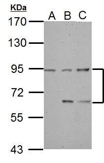 Anti-DEPDC1 antibody [C2C3], C-term used in Western blot. GTX117924