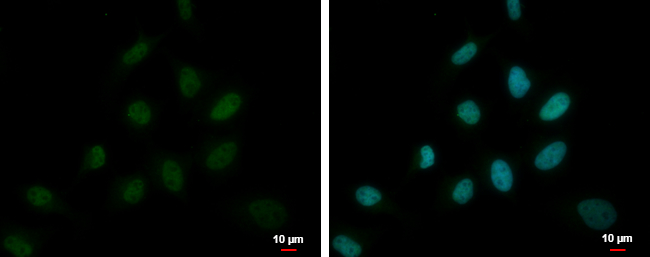 Anti-DEPDC1 antibody [C2C3], C-term used in ICC/IF. GTX117924