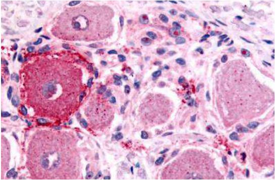 Anti-5-HT1D receptor antibody used in IHC (Formalin-fixed paraffin-embedded sections). GTX78107