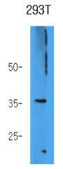 Anti-AKR7A3 antibody [AT2E11] used in Western blot. GTX53685