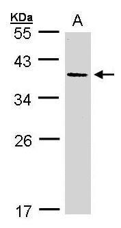 Anti-AKR7A3 antibody [N3C3] used in Western blot. GTX106613