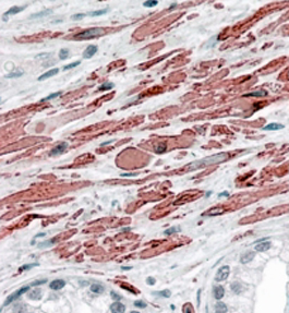 Anti-Desmin antibody, C-term used in IHC (Formalin-fixed paraffin-embedded sections). GTX88510