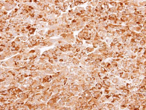 Anti-AKR7A3 antibody [N3C3] used in IHC (Formalin-fixed paraffin-embedded sections). GTX106613