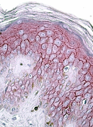 Anti-Desmoglein 1 / DSG1 antibody, Internal used in IHC (Formalin-fixed paraffin-embedded sections). GTX88319