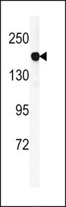 Anti-DGKK antibody used in Western blot. GTX53597