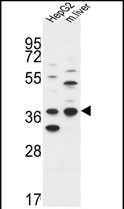 Anti-DHRS3 antibody, Internal used in Western blot. GTX80507