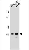 Anti-DHRS4L1 antibody used in Western blot. GTX53550