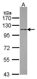 Anti-DHX16 antibody [C1C3] used in Western blot. GTX115088