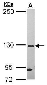 Anti-DHX37 antibody [C2C3], C-term used in Western blot. GTX118579