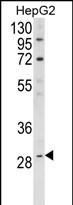 Anti-DIO1 antibody, N-term used in Western blot. GTX81625