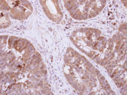 Anti-DIS3L2 antibody [N2C1], Internal used in IHC (Formalin-fixed paraffin-embedded sections). GTX118786
