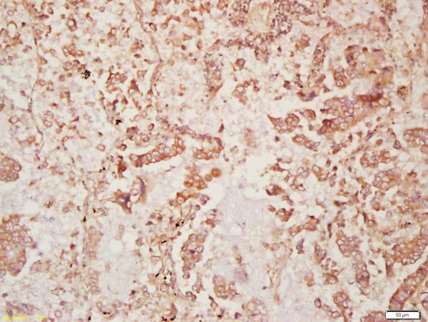 Anti-DISP2 antibody used in IHC (Formalin-fixed paraffin-embedded sections). GTX51129