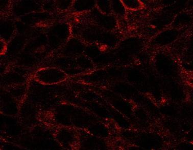 Anti-Dispatched homolog 1 antibody, C-term used in ICC/IF. GTX10142