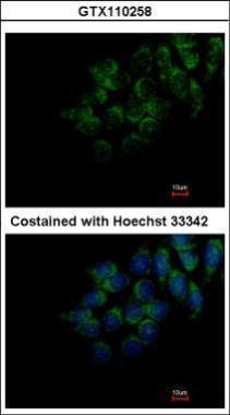 Anti-DMP4 antibody used in ICC/IF. GTX110258