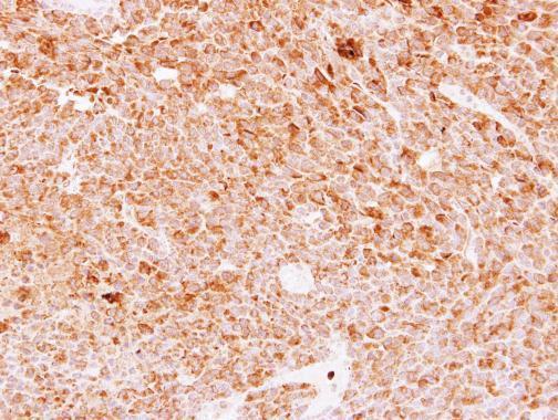 Anti-DMP4 antibody used in IHC (Formalin-fixed paraffin-embedded sections). GTX110258