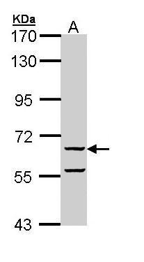 Anti-DMP4 antibody used in Western blot. GTX110258