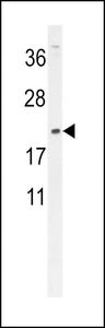 Anti-DMRTC1 antibody used in Western blot. GTX53539