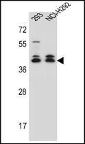 Anti-DMRTC2 antibody used in Western blot. GTX53556