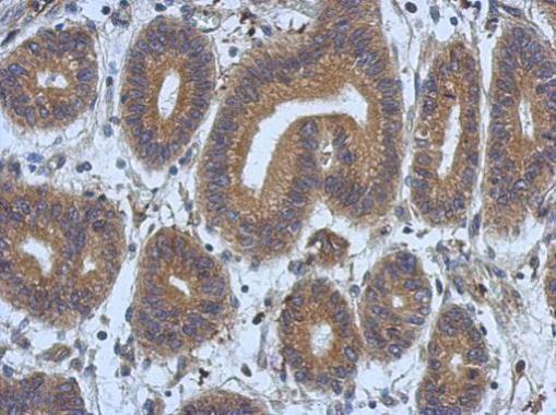 Anti-DNAJB12 antibody [N2C3] used in IHC (Formalin-fixed paraffin-embedded sections). GTX103639