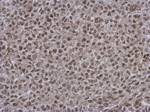 Anti-DNAJB7 antibody used in IHC (Formalin-fixed paraffin-embedded sections). GTX123260