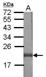 Anti-DNAJB8 antibody [N1C3] used in WB-Ag. GTX122968